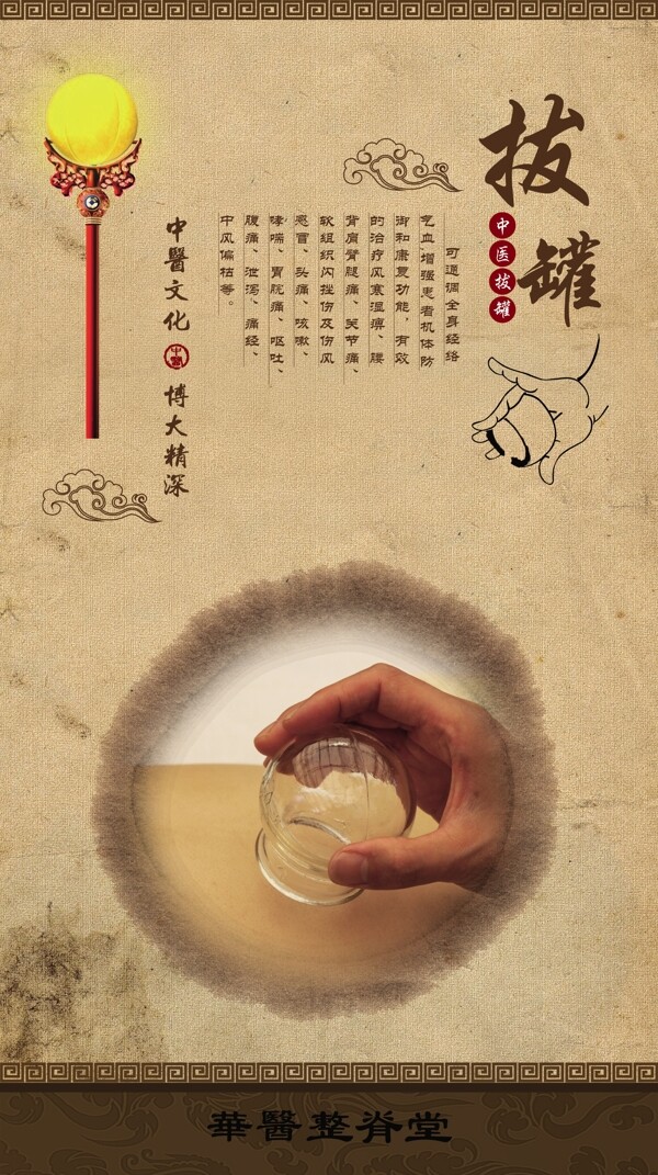 拔罐圖片
