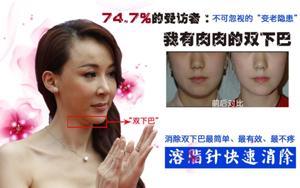 整形美容行業(yè)去雙下巴廣告設(shè)計(jì)圖