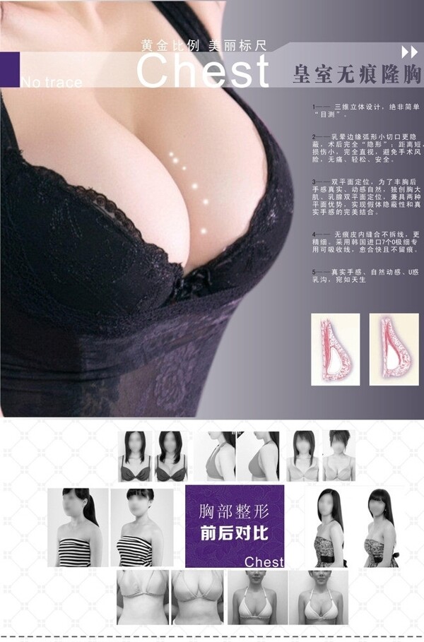 隆胸整形海報圖片