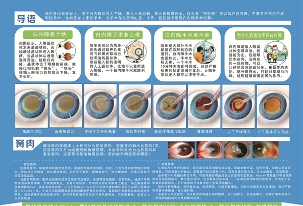 眼科白內(nèi)障單頁