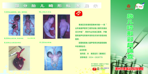 胎兒畸形彩超篩查