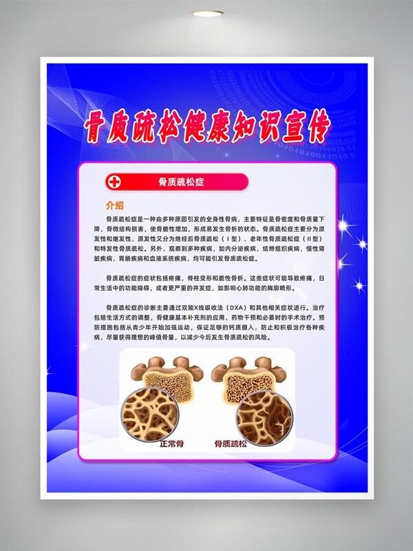 骨質(zhì)疏松健康知識宣傳海報