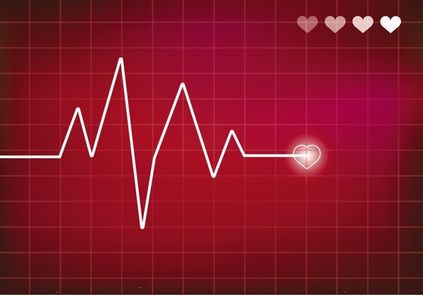 心脏监测向量心电图