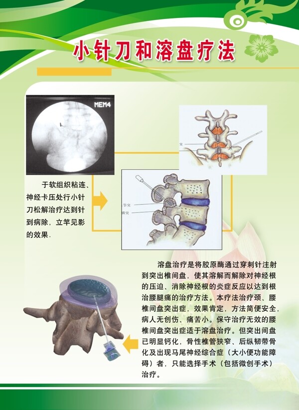 小针刀何溶盘疗法图片