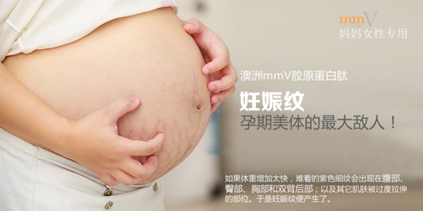 妊娠纹美容护肤功效孕期怀孕胶原