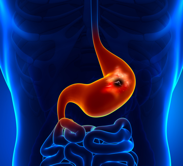 人体胃器官图片