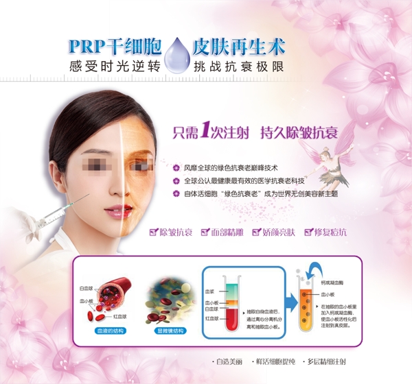 PRP干细胞皮肤再生术